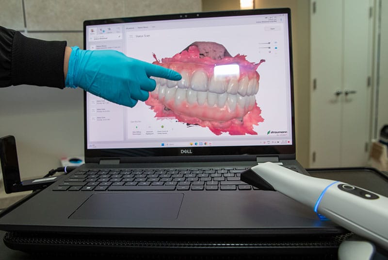 close up of display showing detail 3D model of patient teeth